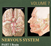 Jones et al. : Nervous System - Spinal Cord and Peripheral Nervous System